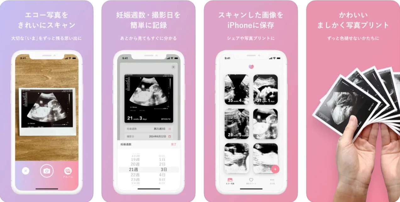 エコー写真