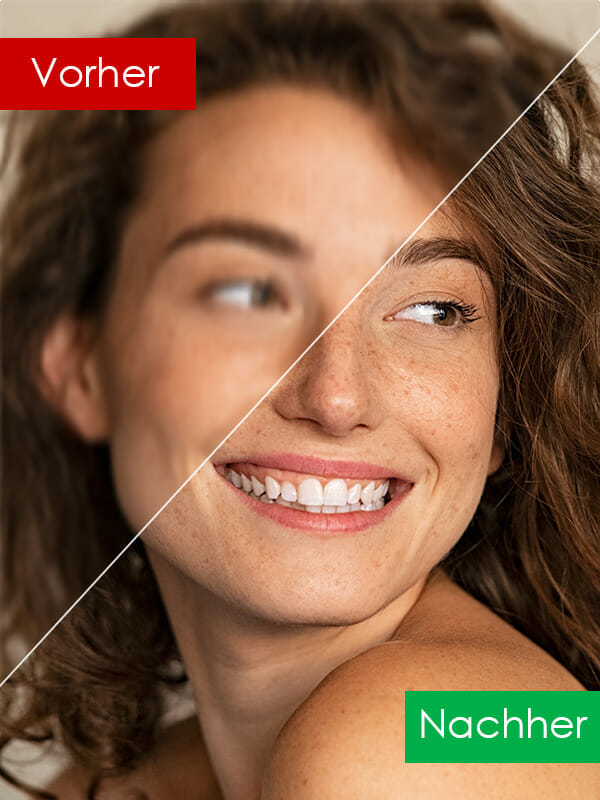 Foto einer Frau mit Sommersprossen vor und nach dem unscharfes Bild scharf machen online